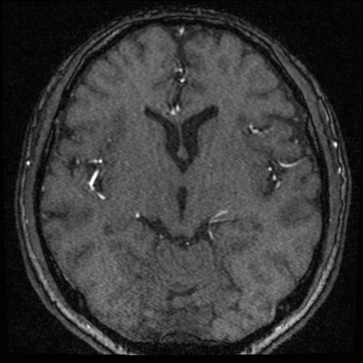 Click on the Serie image to view the images of VILLANUEVA, WILLIAM A.